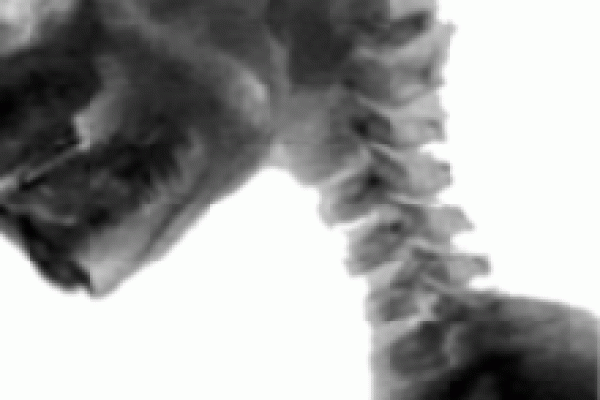 anatomie001C7F2FBFA-490D-7FE1-1F05-02FA53223245.gif